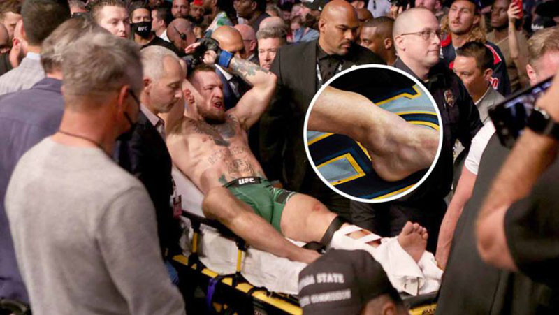 Petarung UFC, Connor McGregor, mengalami patah kaki saat kalah dari Dustin Poirier di UFC 264 di T-Mobile Arena, Las Vegas, Ahad (11/7/2021).Â 
